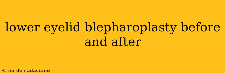lower eyelid blepharoplasty before and after