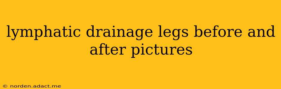 lymphatic drainage legs before and after pictures