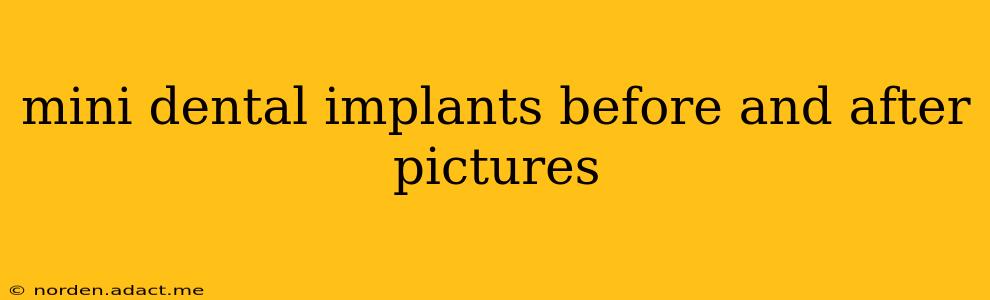 mini dental implants before and after pictures