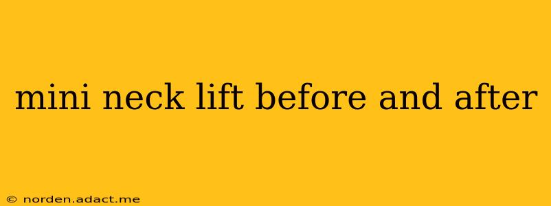 mini neck lift before and after