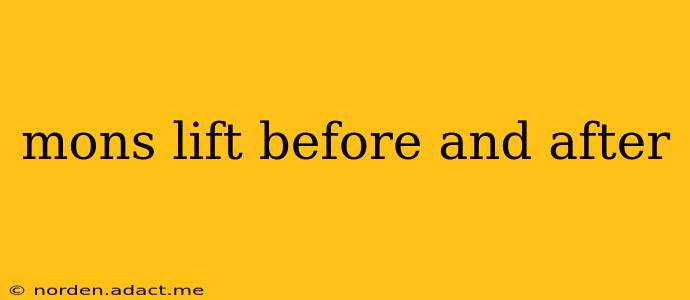 mons lift before and after