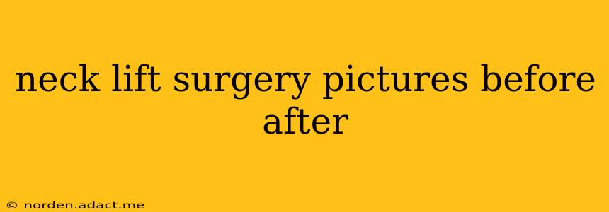 neck lift surgery pictures before after