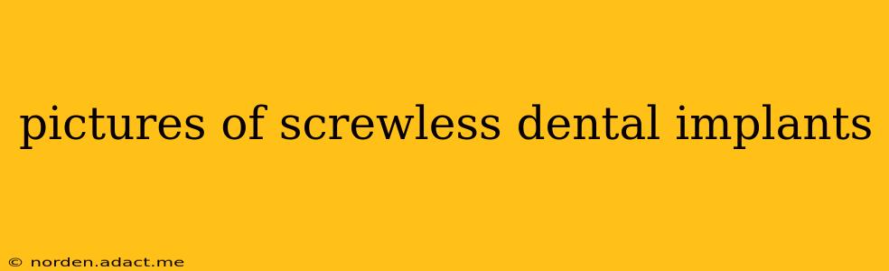 pictures of screwless dental implants