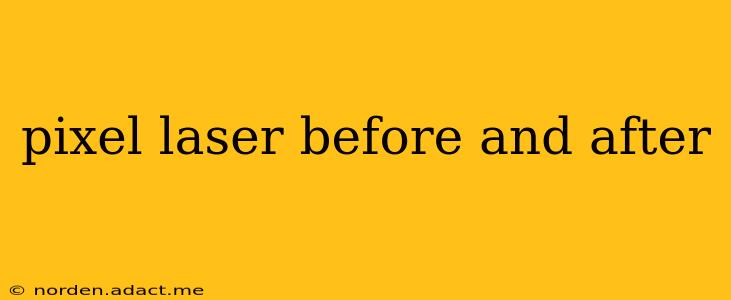 pixel laser before and after