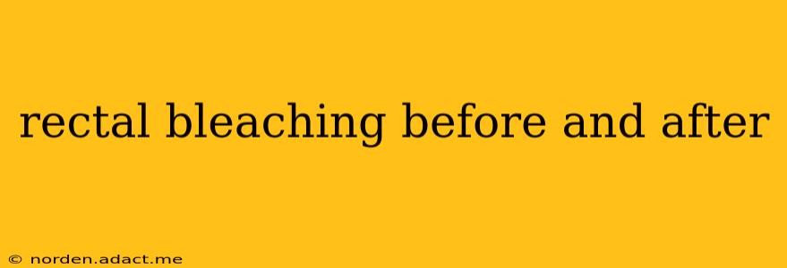 rectal bleaching before and after