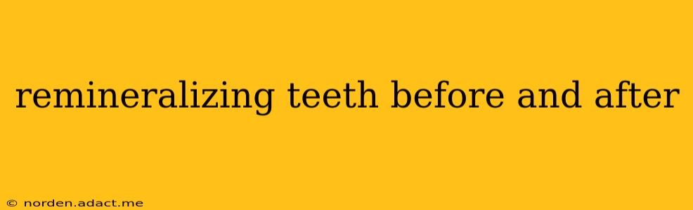 remineralizing teeth before and after