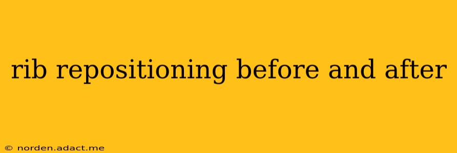 rib repositioning before and after