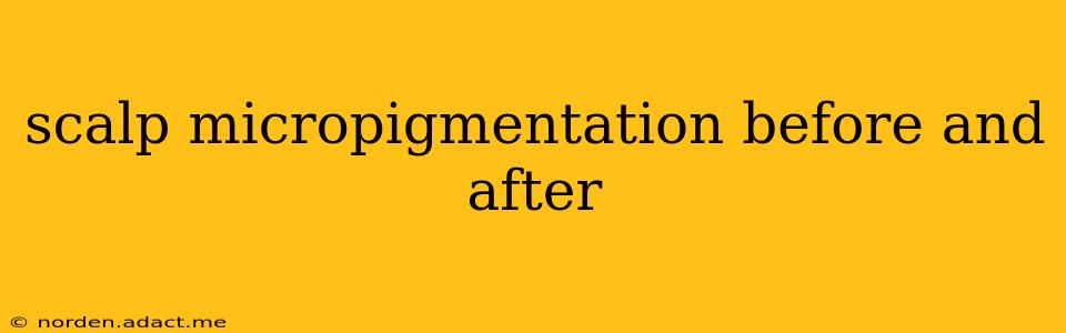 scalp micropigmentation before and after