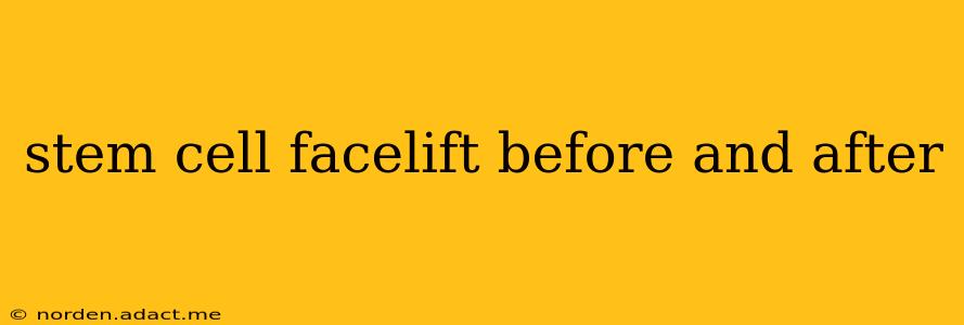 stem cell facelift before and after