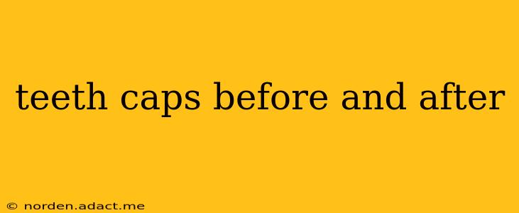 teeth caps before and after