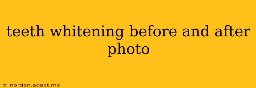 teeth whitening before and after photo