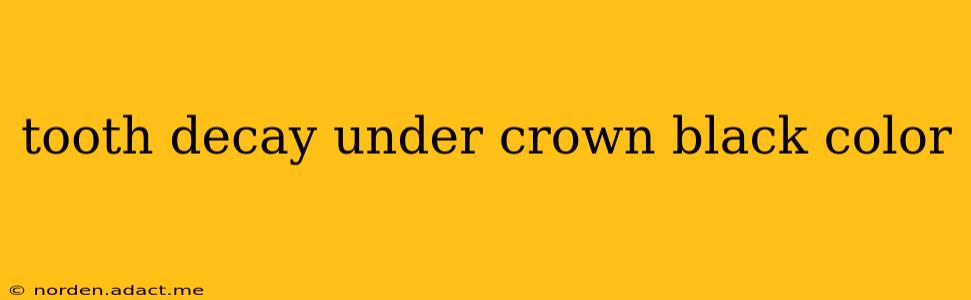 tooth decay under crown black color