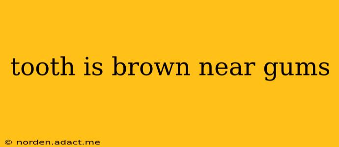 tooth is brown near gums