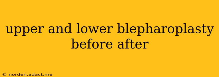 upper and lower blepharoplasty before after