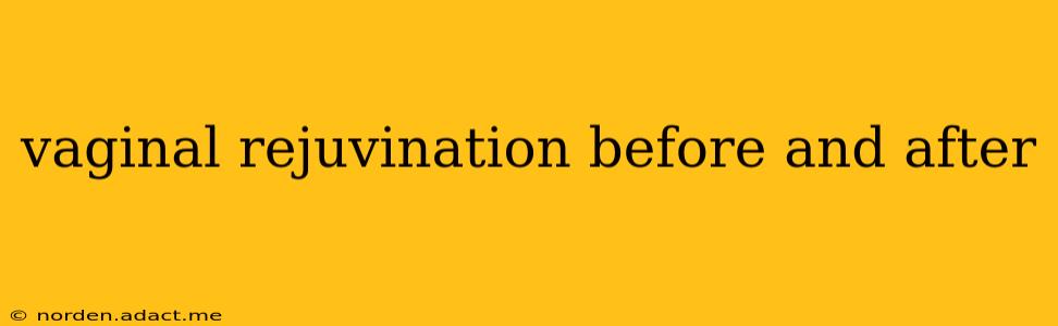 vaginal rejuvination before and after