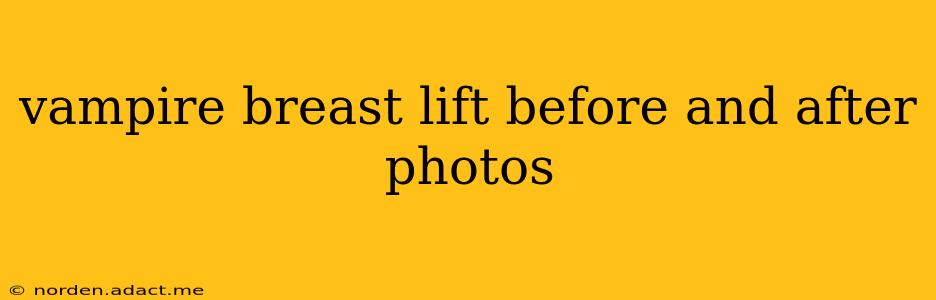vampire breast lift before and after photos
