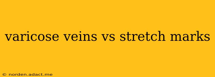 varicose veins vs stretch marks