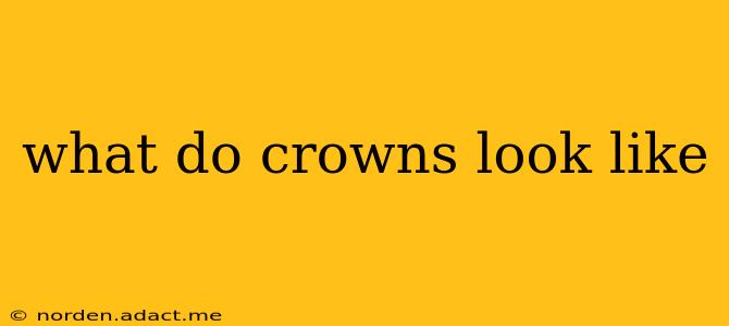 what do crowns look like