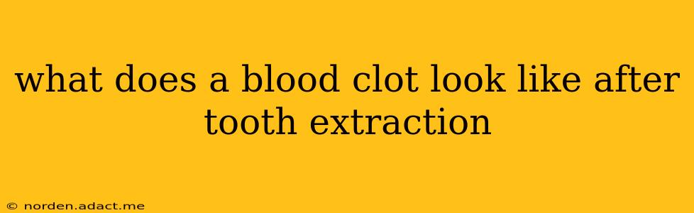 what does a blood clot look like after tooth extraction