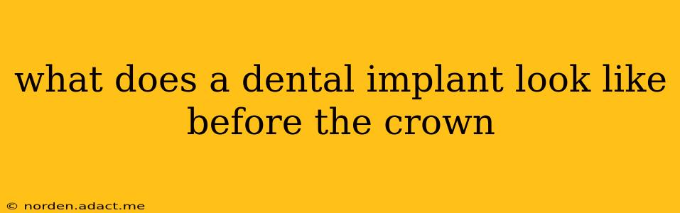what does a dental implant look like before the crown