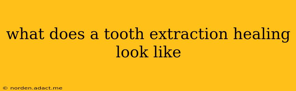 what does a tooth extraction healing look like