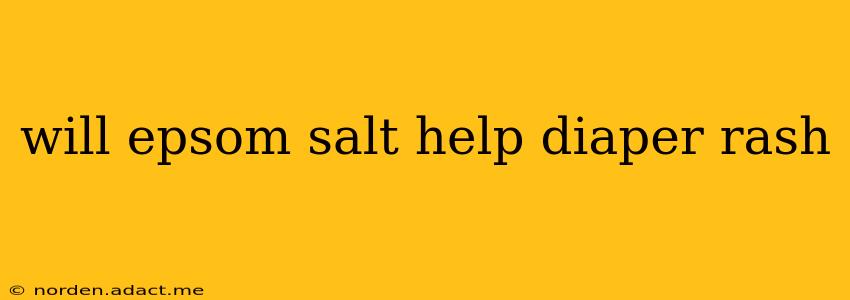 will epsom salt help diaper rash