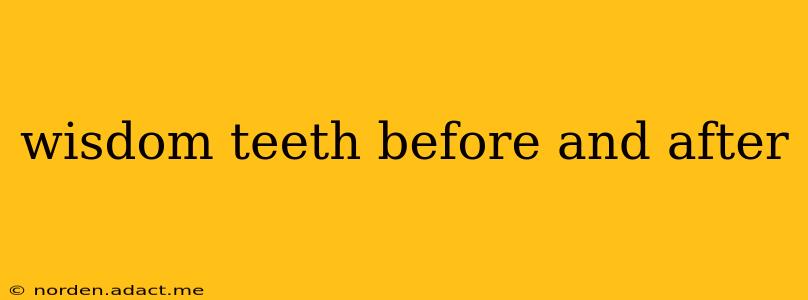 wisdom teeth before and after